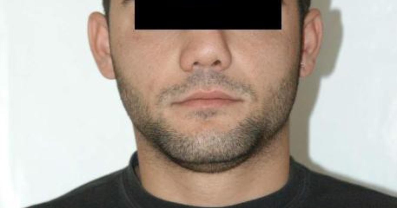 Viene sorpreso da un agente mentre ruba auto e lui si vendica con testa d'agnello mozzata