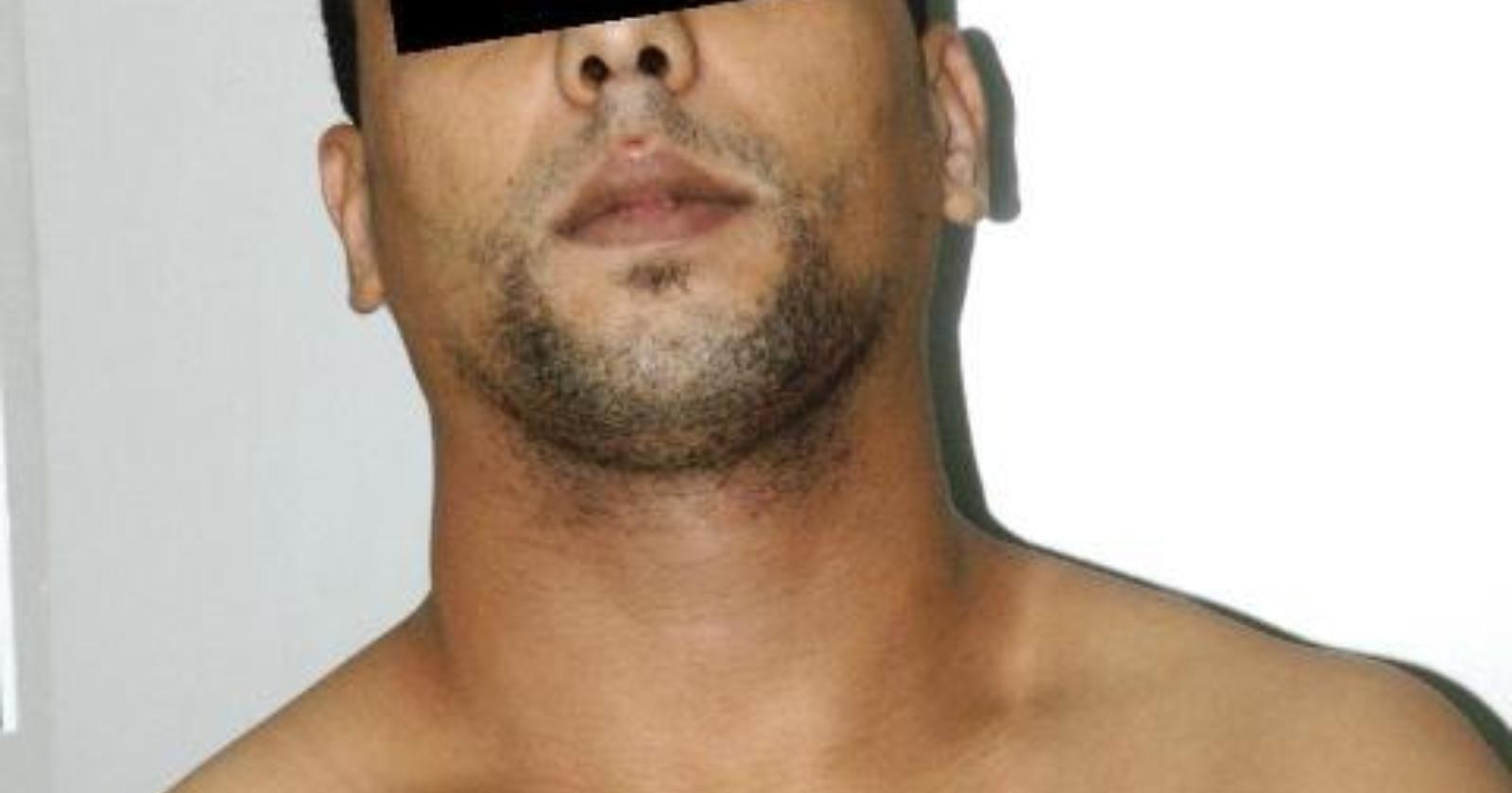 Cerignola, lotta al crimine: tre arresti per droga e rissa