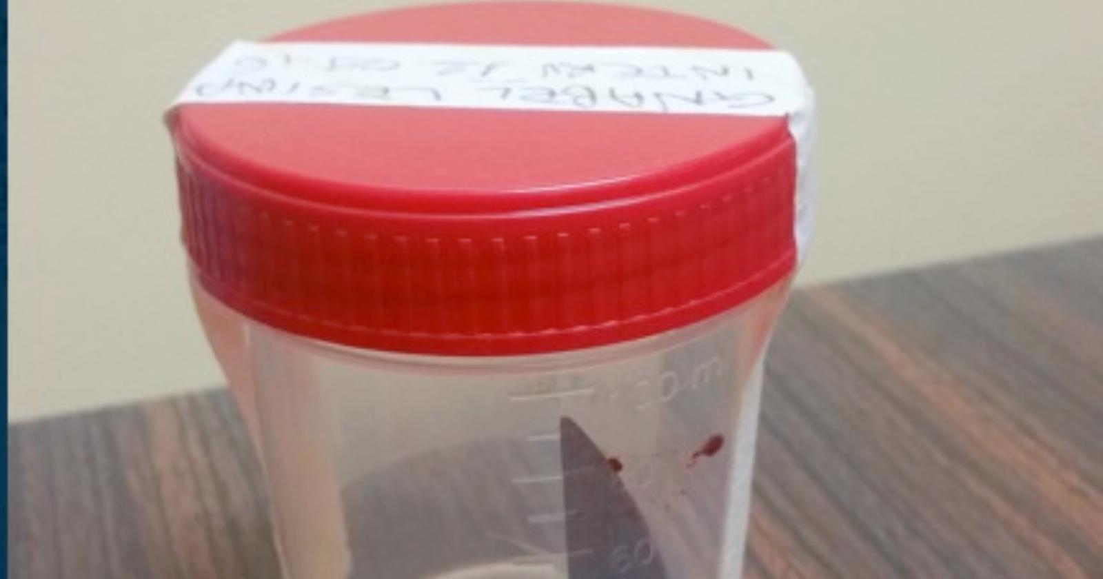 Cara di Borgo Mezzanone: ubriaco accoltella il vicino di stanza, fermato africano