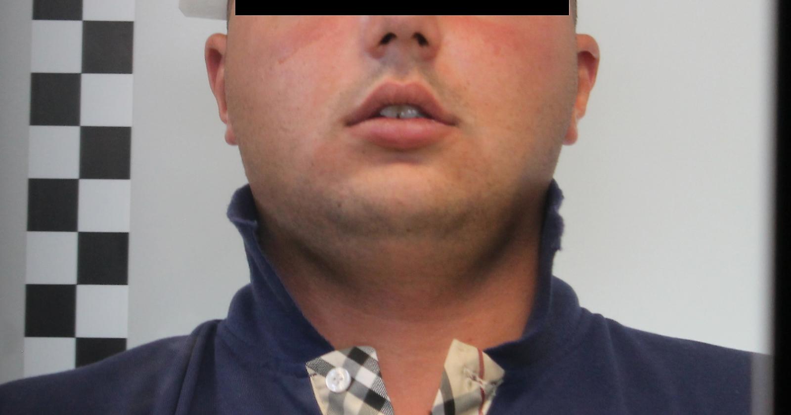 Tenta di uccidere il proprio meccanico: arrestato noto pregiudicato foggiano 