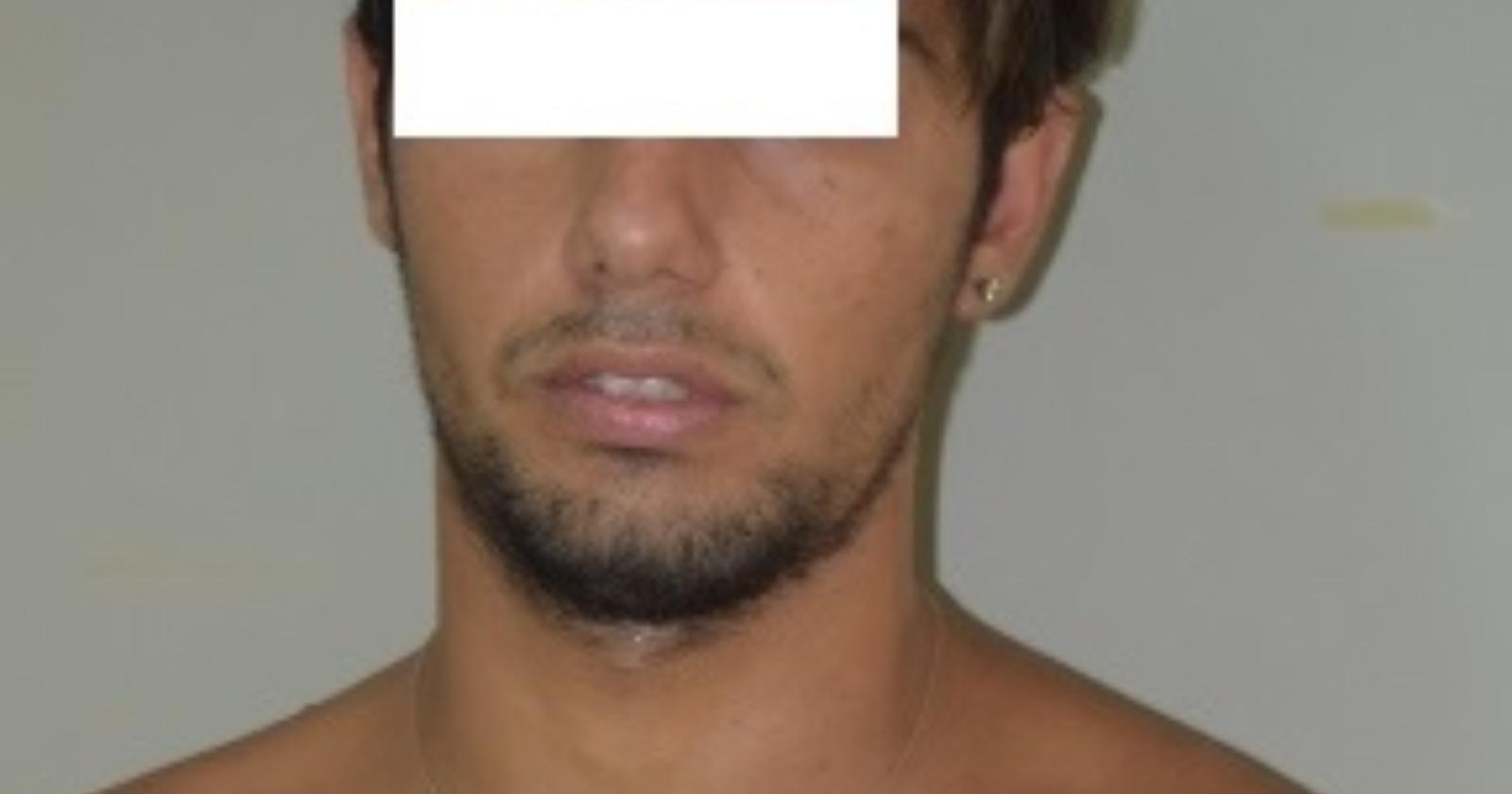 Quartiere San Samuele, escono di casa con mazze e grosso cacciavite  e se le danno di santa ragione: tre arresti 