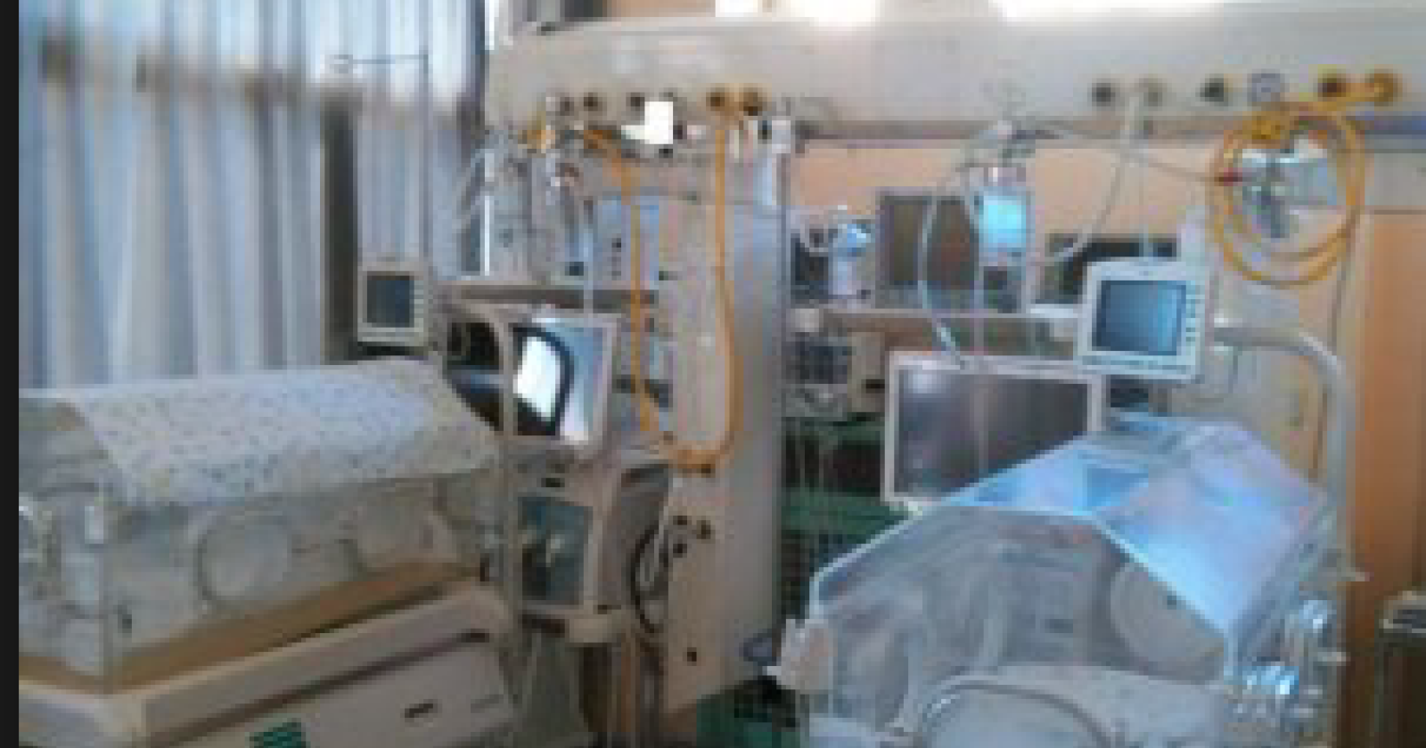 Miracolo vita agli Ospedali Riuniti di Foggia: dimessa la bimba nata di 300 grammi 