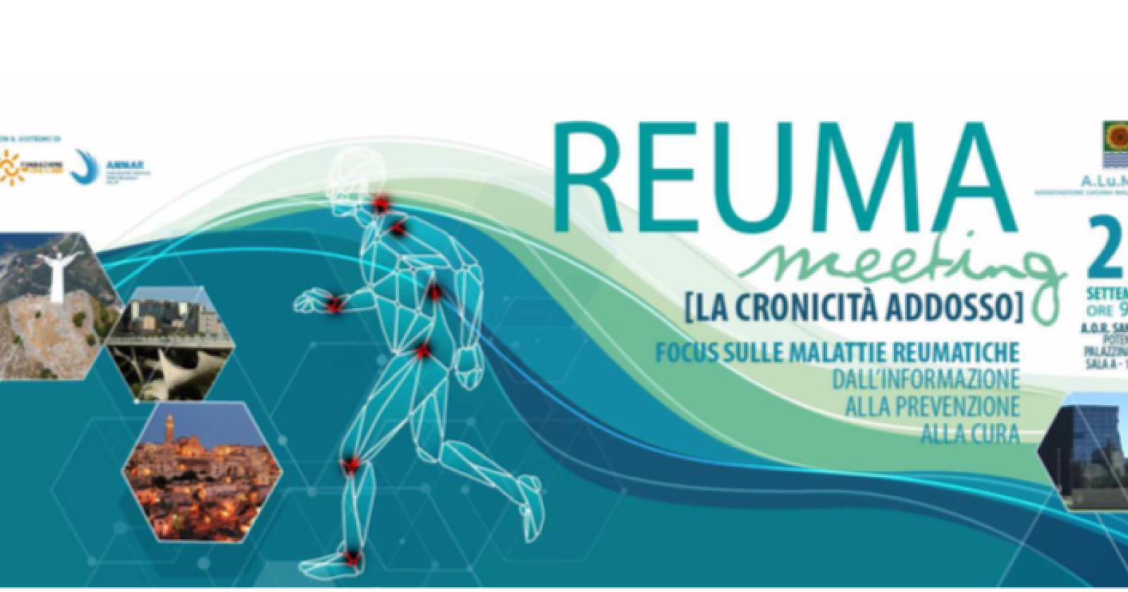 Reuma meeting, al San Carlo di Potenza il convegno sulle malattie reumatiche