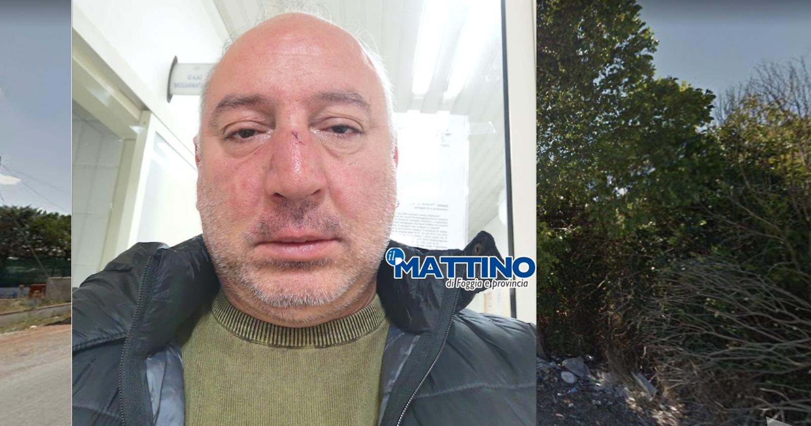 Foggia, consigliere comunale dice di non gettare i rifiuti sulla strada e in 4 lo massacrano di botte