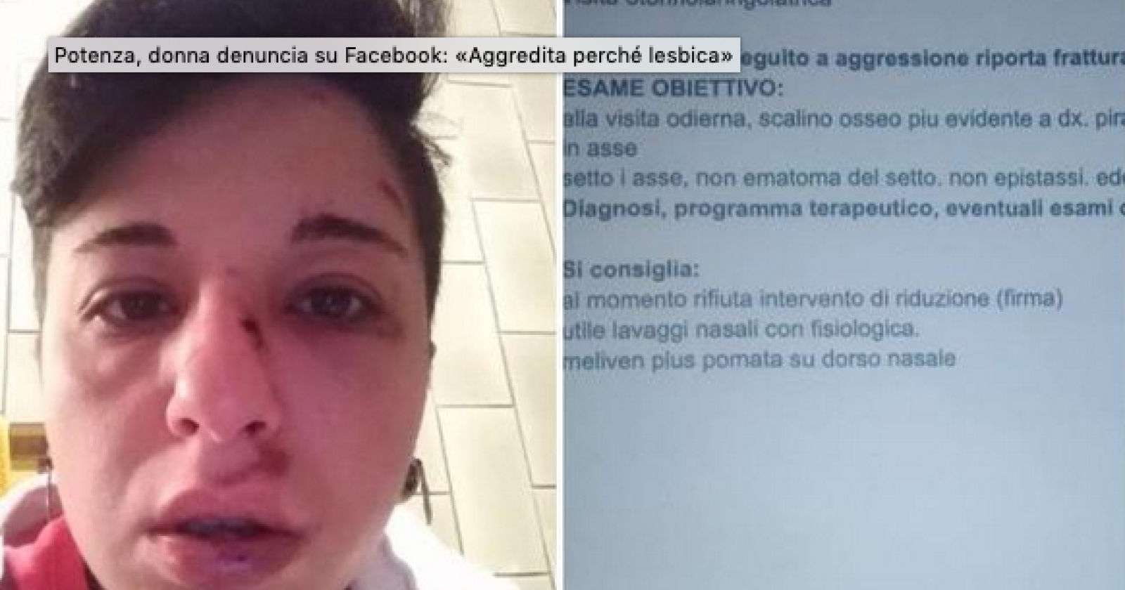 Potenza, donna denuncia: «Aggredita da due fascistelli perché lesbica»