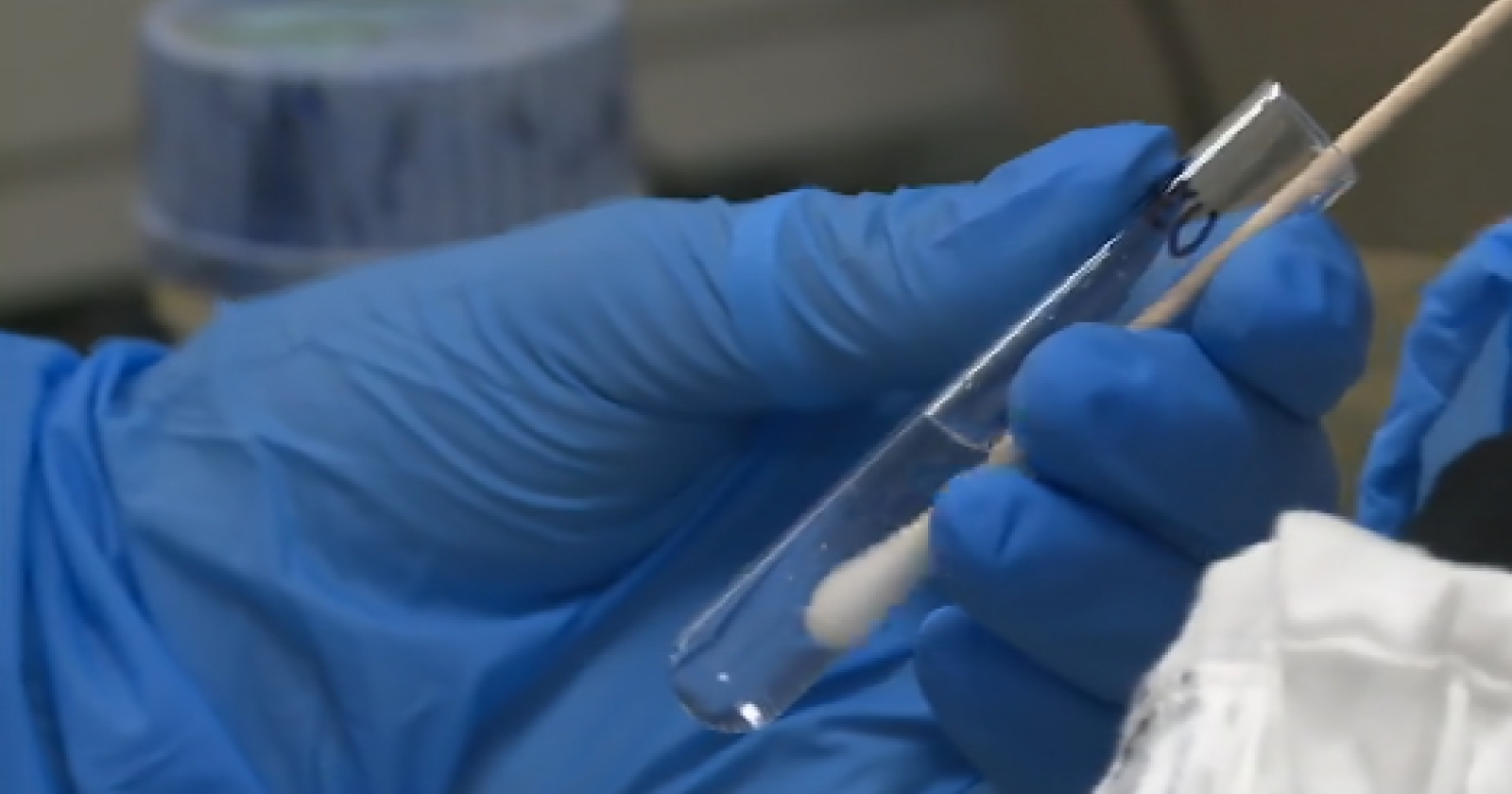 Coronavirus, Nnegativi gli ultimi cinque tamponi processati al San Carlo