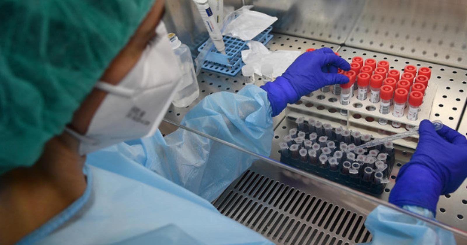 Il Coronavirus continua la sua corsa: 85 nuovi positivi in regione 