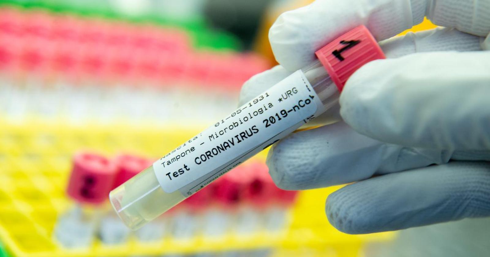 Covid. In Basilicata nel fine settimana 34 positivi su 756 tamponi