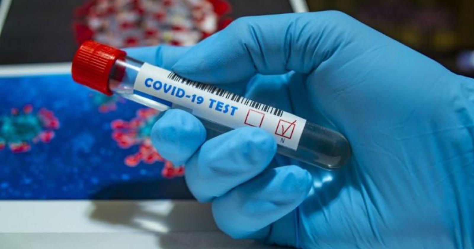 Basilicata, Covid in retromarcia: 24 tamponi positivi su 900 nelle ultime 24 ore e nessun nuovo ricovero