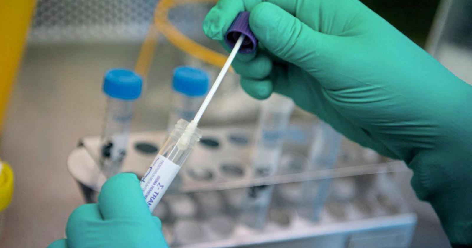 Test degli anticorpi, parla Nino Mazzone medico in prima linea: «Dal Cts inascoltati e derisi da un anno»