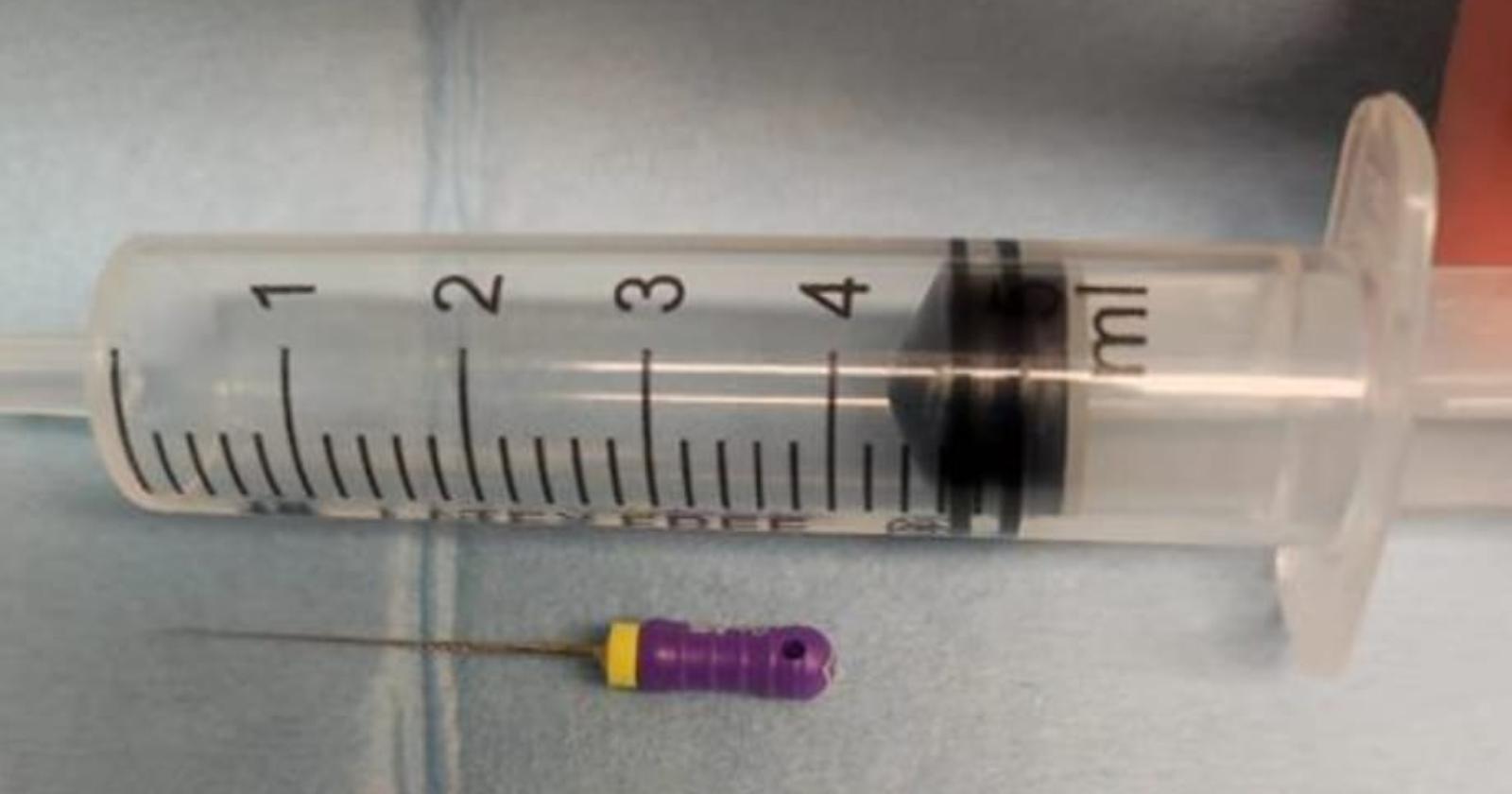 Inala un ago per la devitalizzazione dentale: la corsa da Matera a Bari per una endoscopia d'urgenza