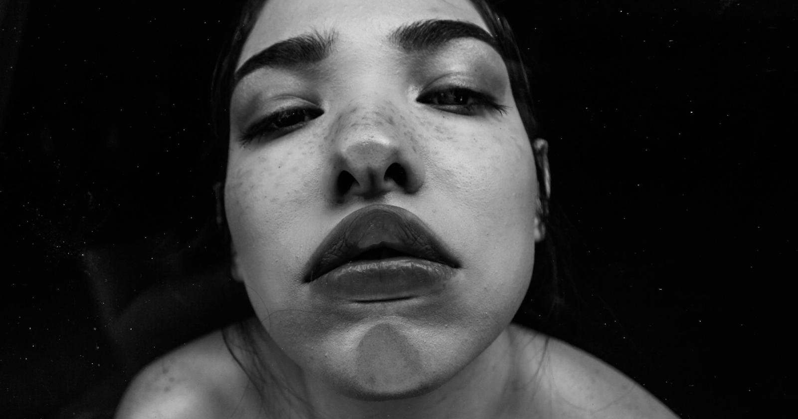 Botulino e ritocchi soft: come stanno cambiando le richieste di medicina estetica per il viso