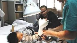 Raccoglie petardo inesploso: perde la mano ragazzino di 14 anni
