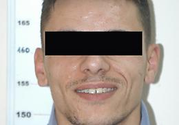 Tentò di estorcere denaro ad un assicuratore: torna in carcere Ivan Narciso