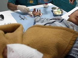 Botti di fine anno, si aggrava il numero dei feriti: 21enne perde la mano destra