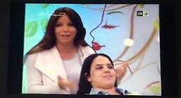 Quei lividi che non vengono via col trucco