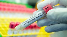 Covid. In Basilicata nel fine settimana 34 positivi su 756 tamponi
