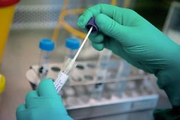 Test degli anticorpi, parla Nino Mazzone medico in prima linea: «Dal Cts inascoltati e derisi da un anno»