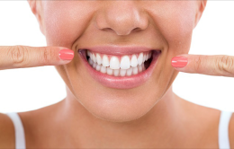 Anche i denti hanno le loro "Faccette" per sembrare più belli