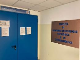 Sanità lucana, l'Asm alla canna del gas cerca anatomopatologi anche in pensione: "Situazione critica"